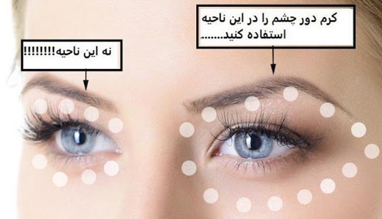 آیا کرم دور چشم موثر است؟